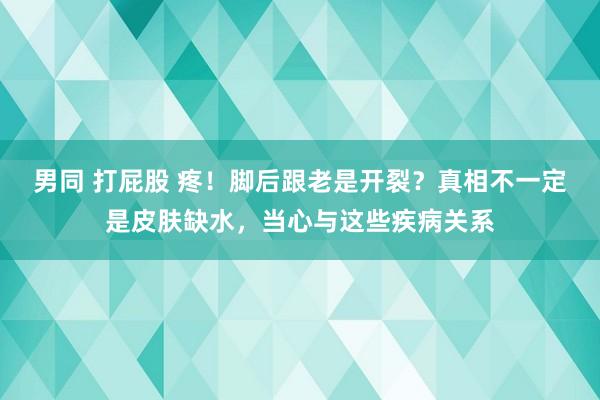 男同 打屁股 疼！脚后跟老是开裂？真相不一定是皮肤缺水，当心与这些疾病关系